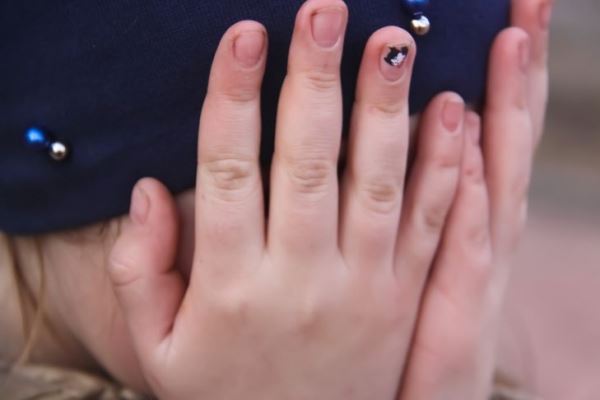 Почему на ногтях появляются белые пятна: медики назвали 7 причин